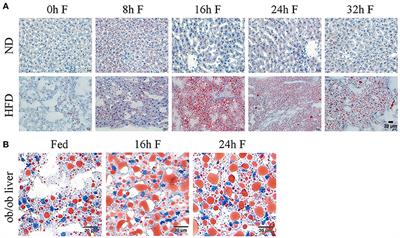 AMPK-PPARγ-Cidec Axis Drives the Fasting-Induced Lipid Droplet Aggregation in the Liver of Obese Mice